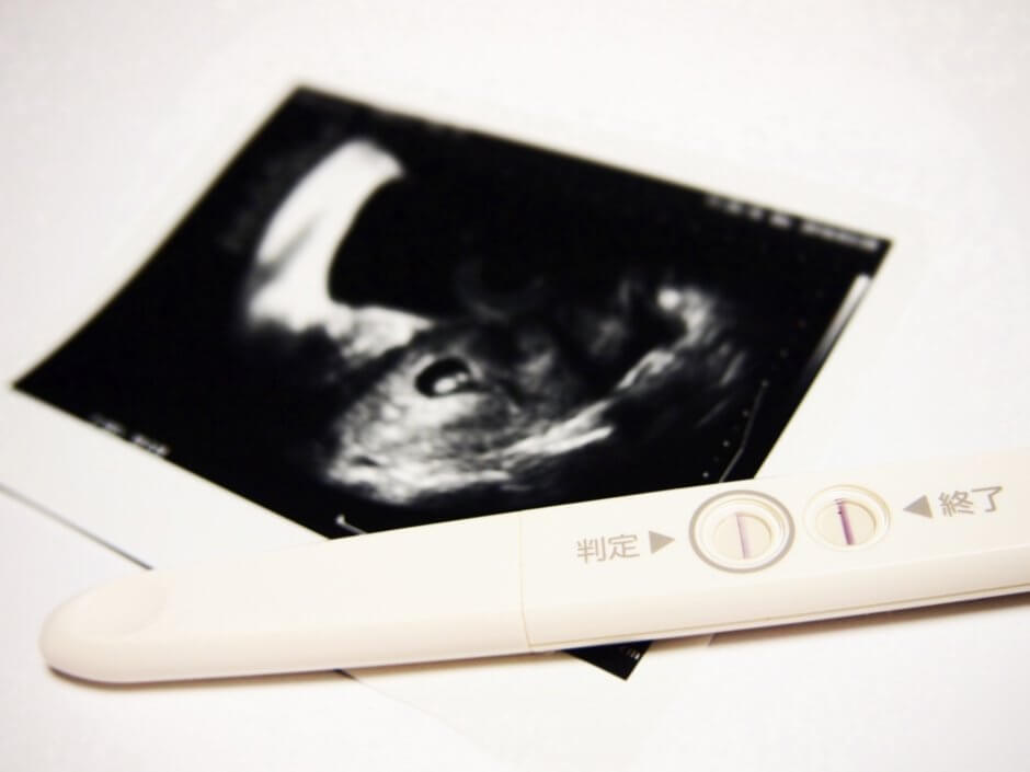 妊娠検査薬とエコー写真